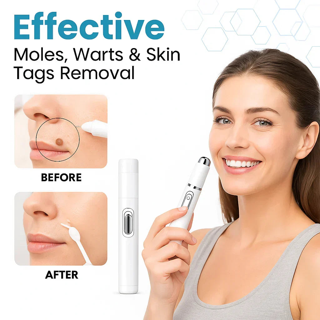 Blue laser pen for stain removal
