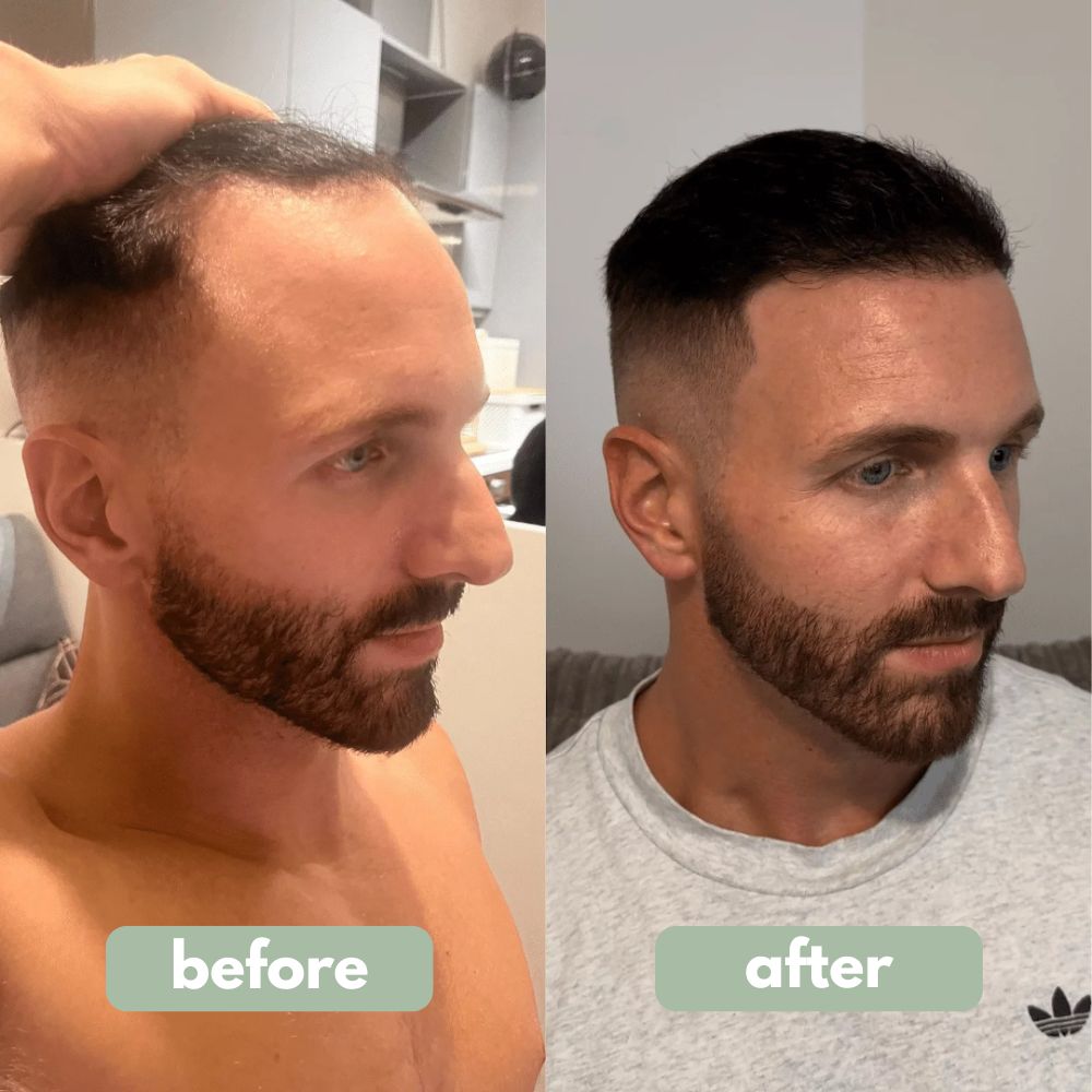 Hair Growth Serum